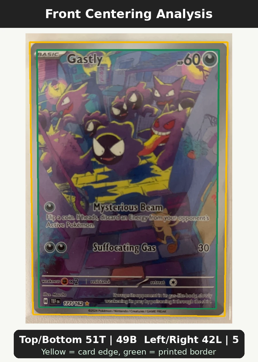 Gastly 177/162 Temporal Forces front centering analysis showing Top/Bottom 51T | 49B and Left/Right 42L | 58R.